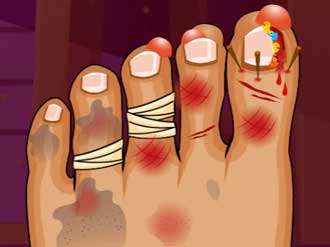 Play Monster Foot Doctor Thumbnail