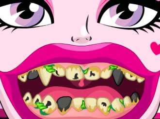 Play Draculaura Bad Teeth Thumbnail
