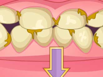 世話ゲーム【Bad Teeth Makeover】ゲームのサムネイル画像
