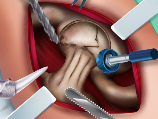 【Ella Hip Surgery】ゲームをプレイする